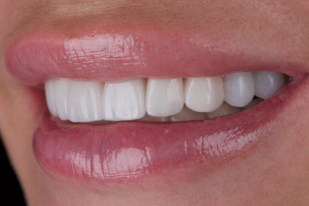 5352694613338612596 (1).jpg