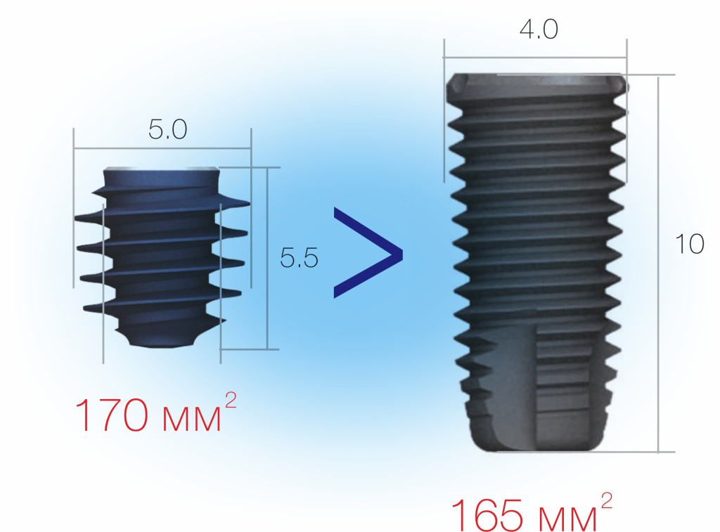 сверхкороткий имплантат.jpg