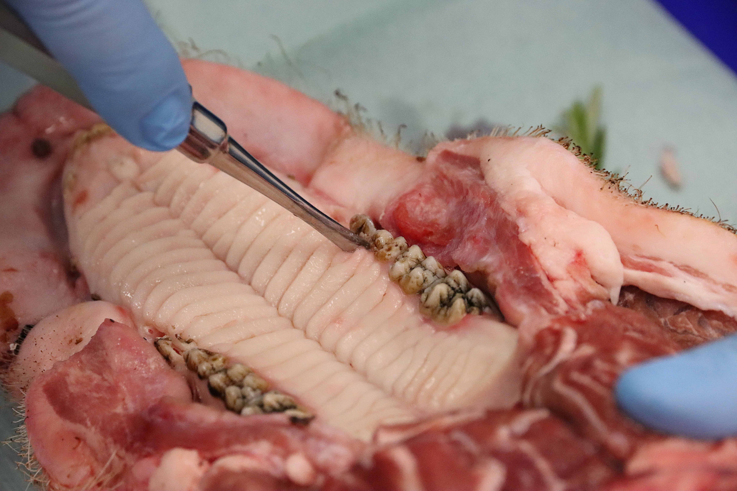 Атравматичное удаление зубов и методики наложения швов