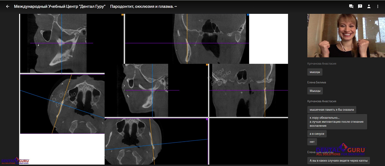 Пост-релиз: Онлайн-курс «Пародонтит, окклюзия и плазма» 29 мая 2020