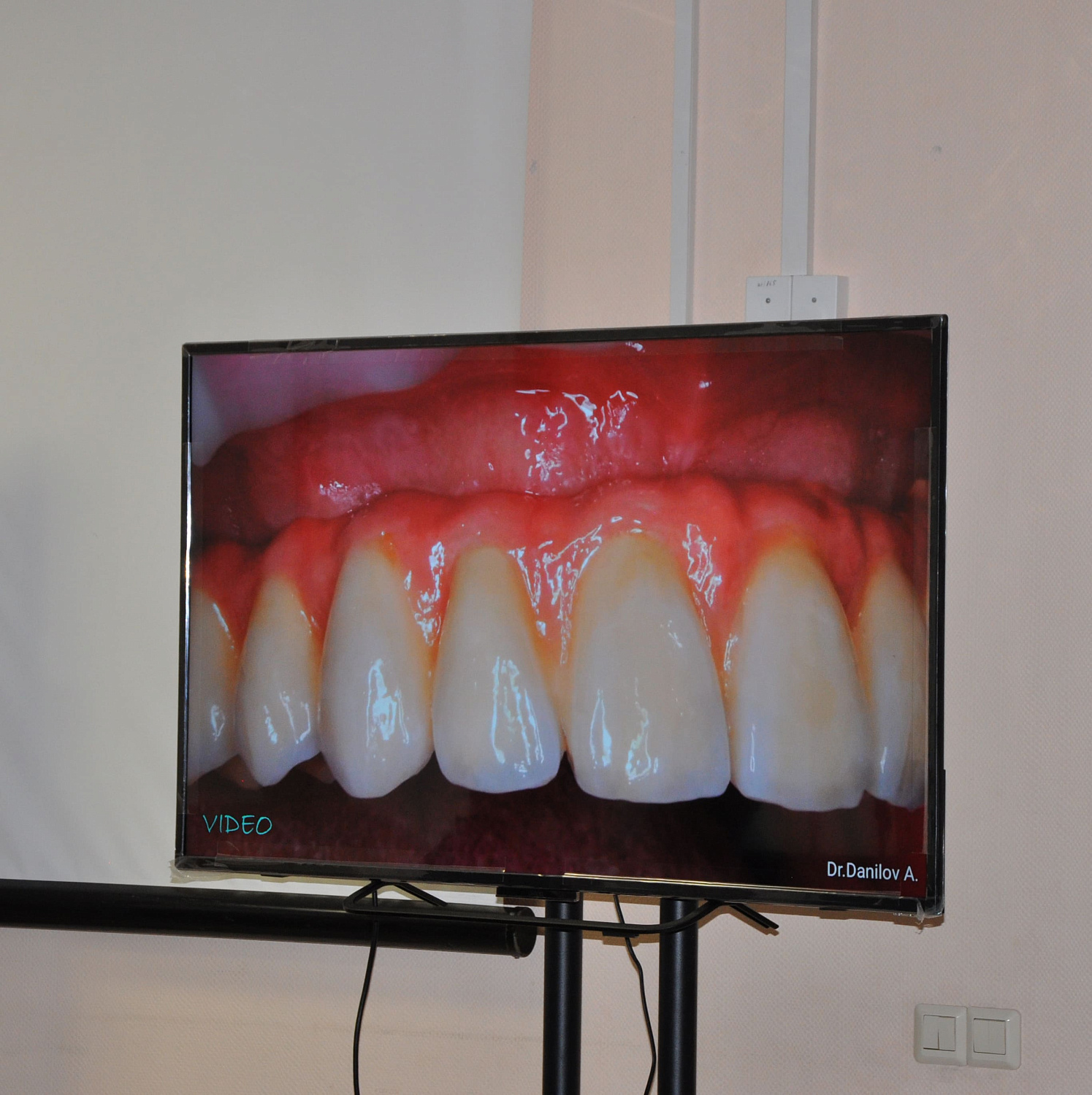 Цифровая навигация с немедленной нагрузкой 