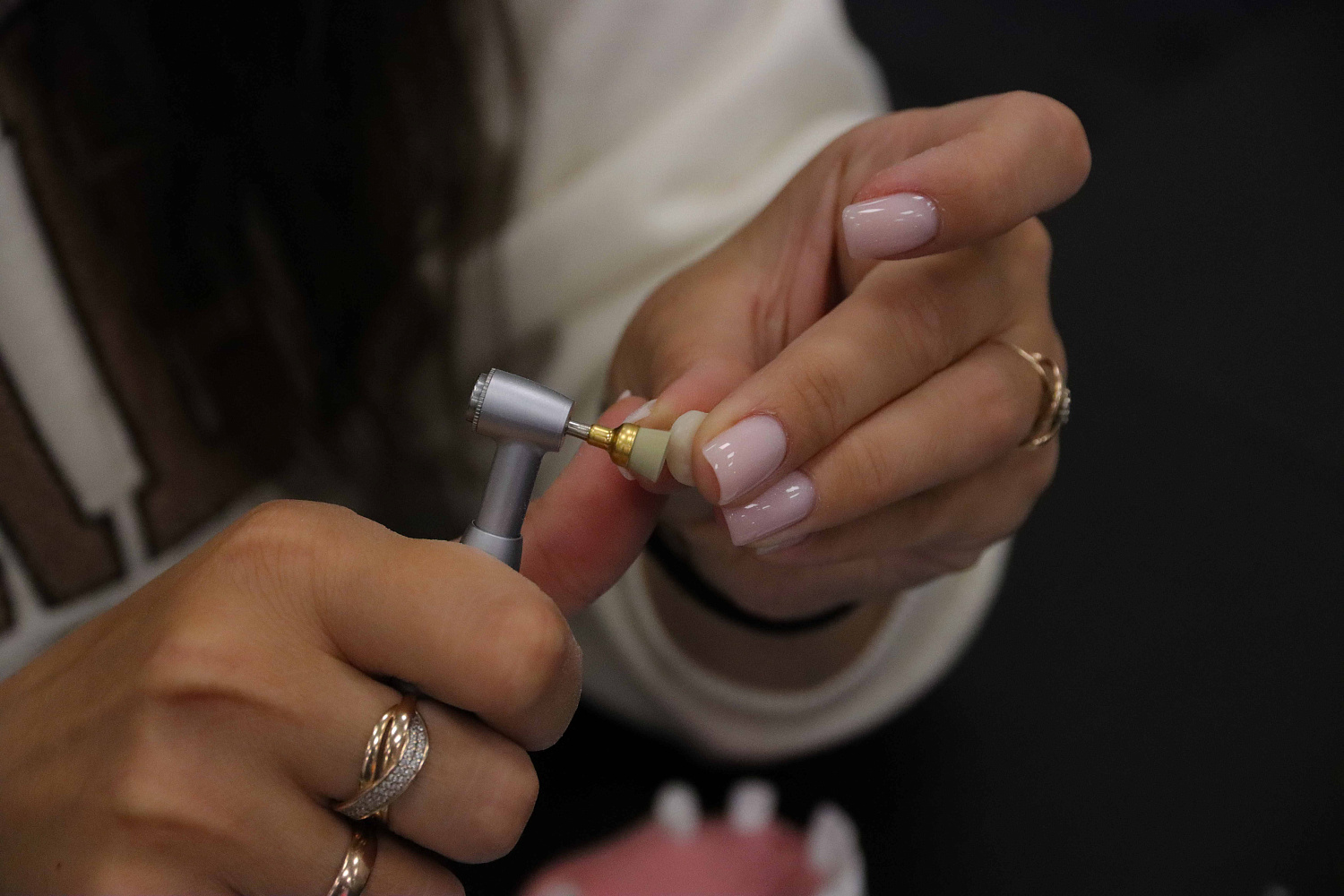 Одномоментная имплантация, немедленная нагрузка и формирование защитного барьера