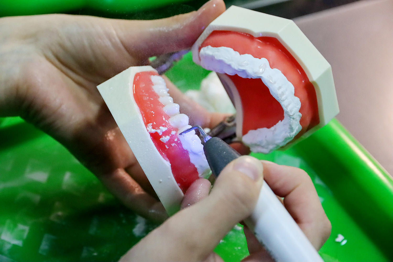 Принципы алгоритмизации при проведении профессиональной гигиены