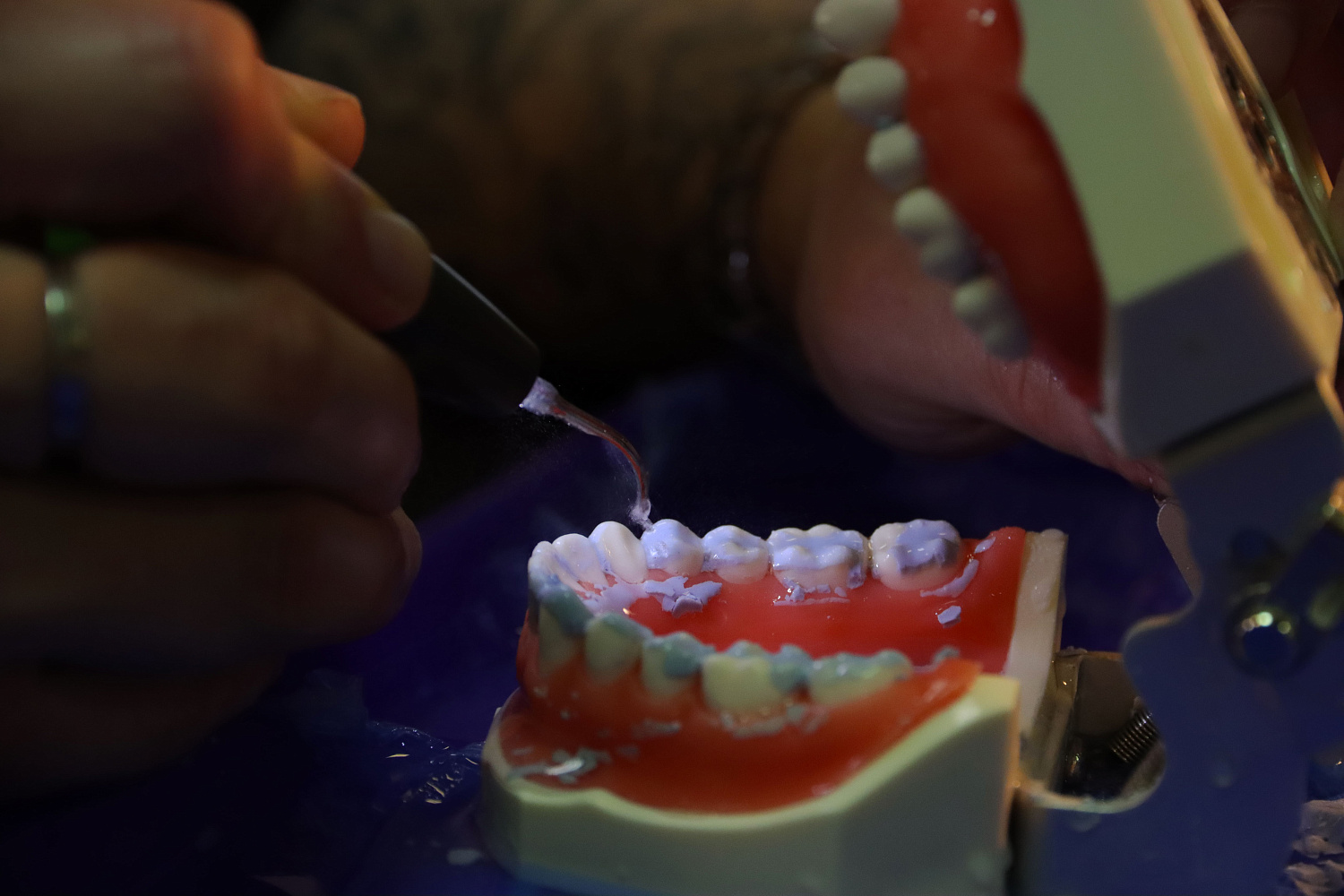 Принципы алгоритмизации при проведении профессиональной гигиены