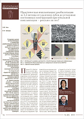 Практическая имплантация: реабилитация за 4,5 месяца от удаления зубов до установки постоянных конструкций при тотальной имплантации - реально ли это ?