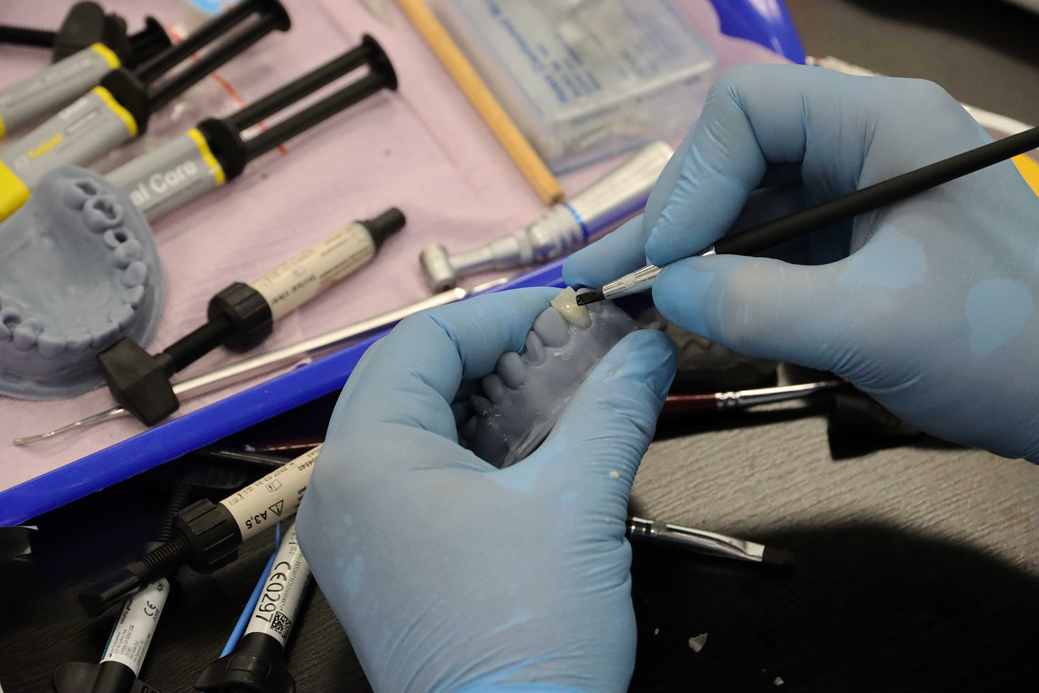 Прямые композитные виниры. Полный алгоритм и немного больше