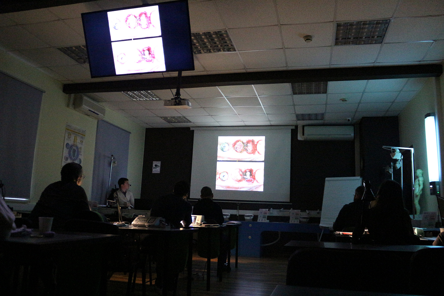 Одномоментная имплантация и немедленная нагрузка. Пост-релиз 4 февраля 2021