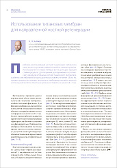 Использование титановых мембран для направленной костной регенерации