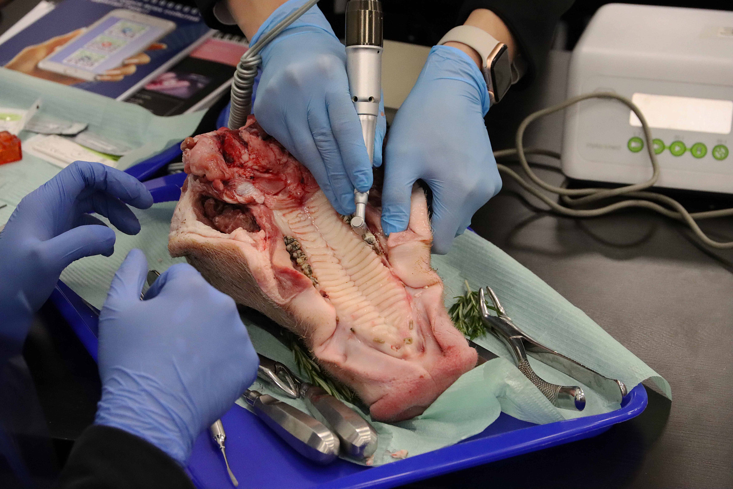 Атравматичное удаление зубов и методики наложения швов