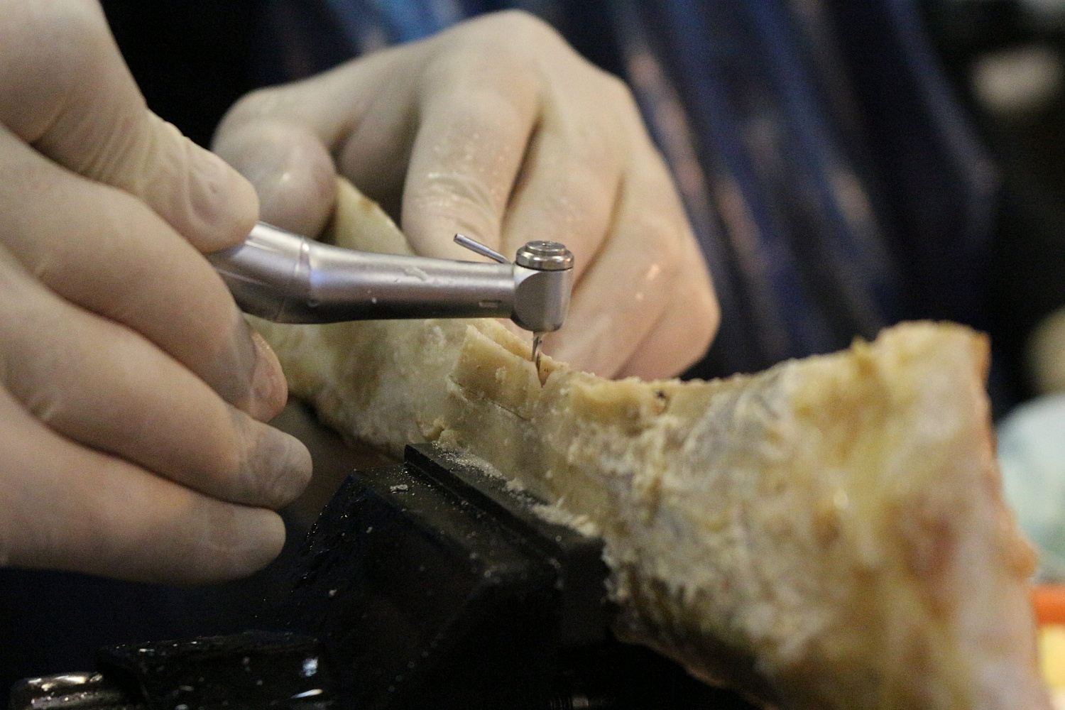 Продвинутый курс по имплантации. Костная пластика. Пост-релиз 10 и 11 марта