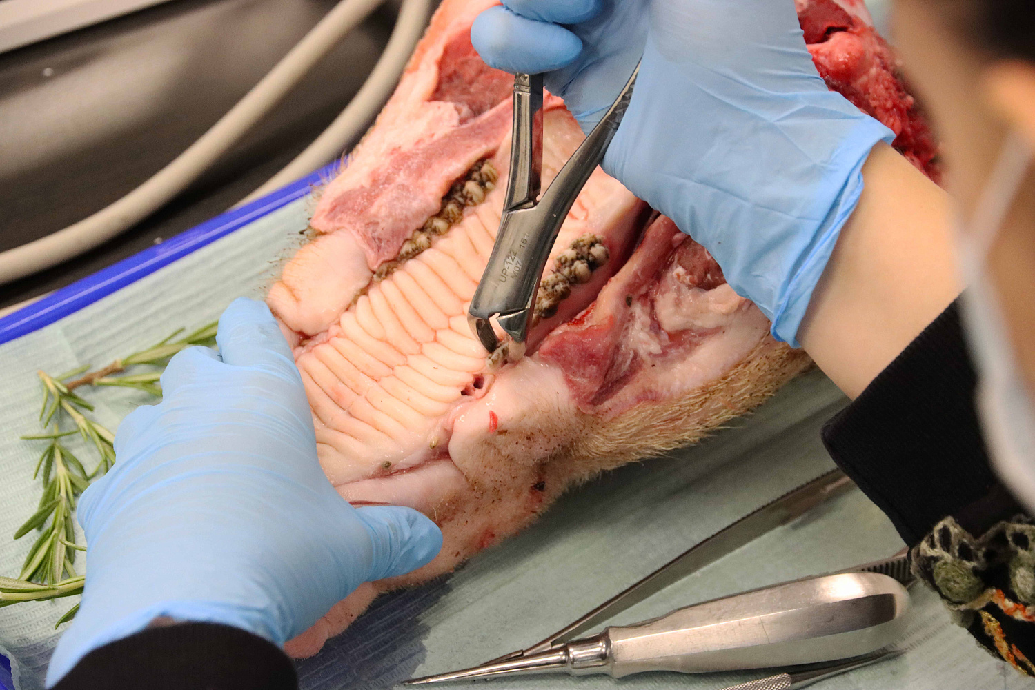 Атравматичное удаление зубов и методики наложения швов