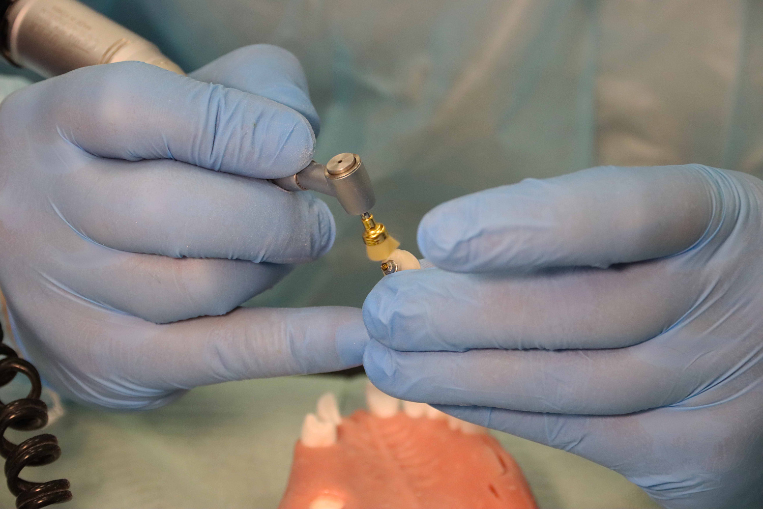 Одномоментная имплантация, немедленная нагрузка и формирование защитного барьера