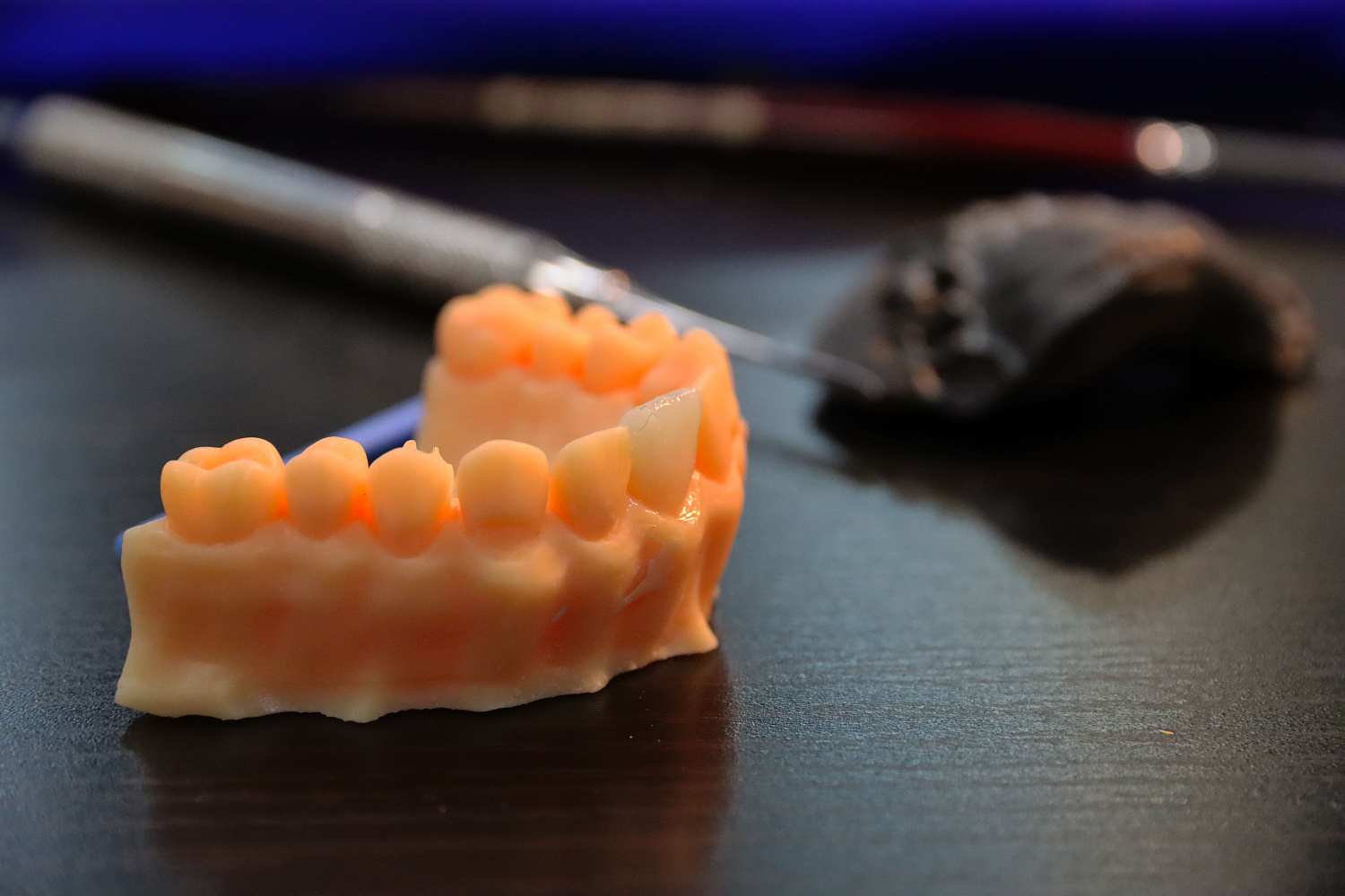 Прямые композитные виниры. Полный алгоритм и немного больше