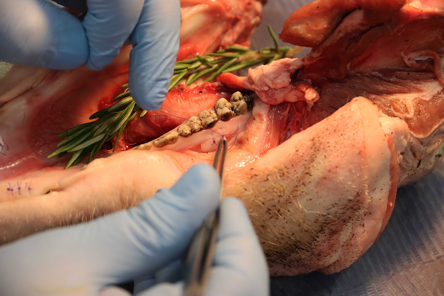 Продвинутый курс по пластике мягких тканей