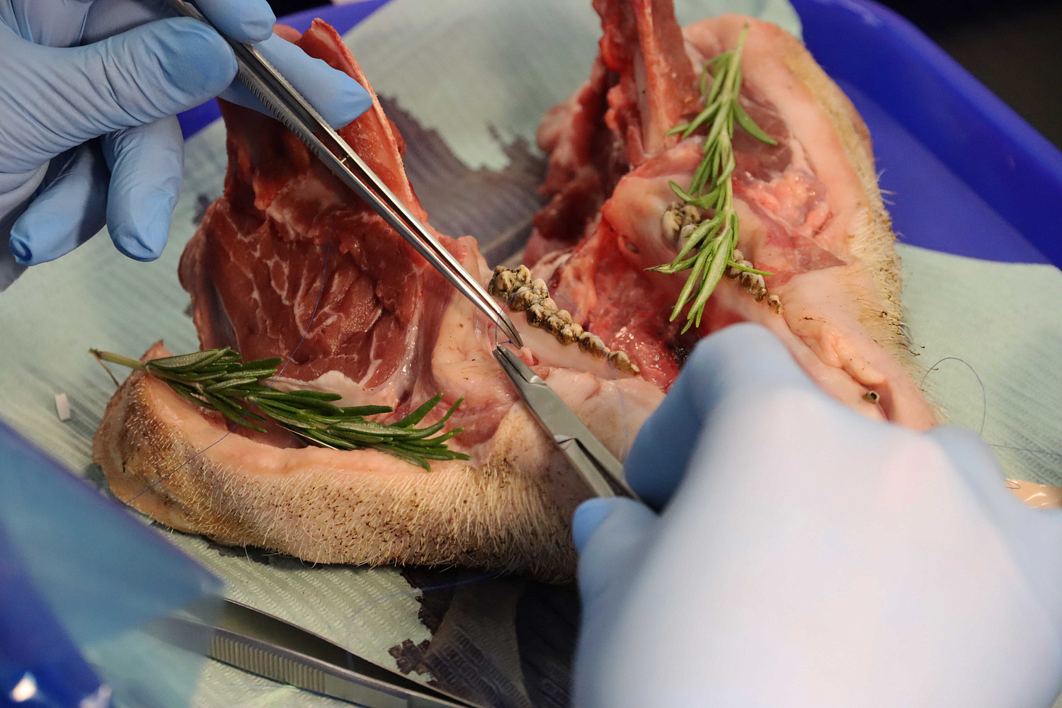 Продвинутый курс по пластике мягких тканей