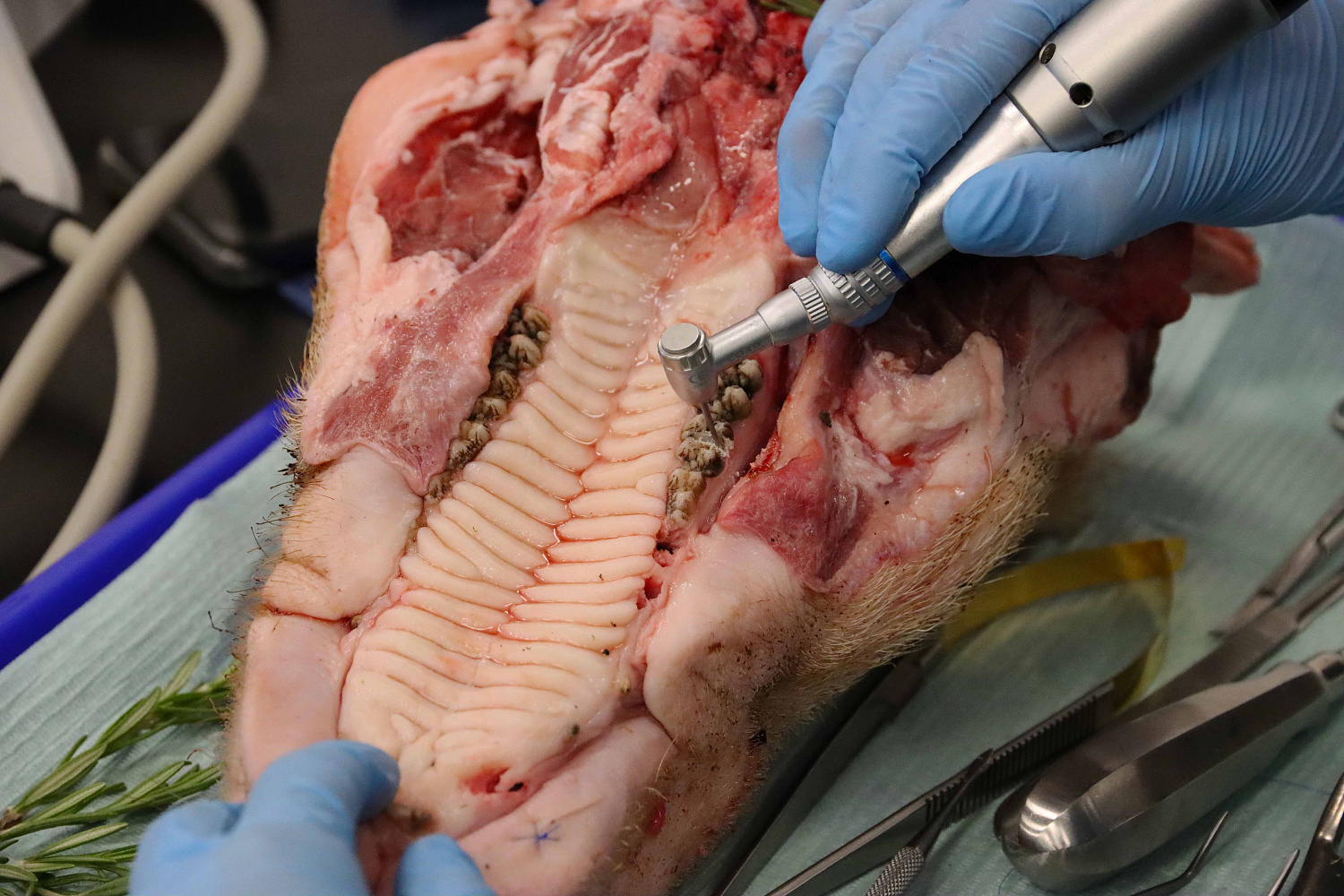 Атравматичное удаление зубов и методики наложения швов