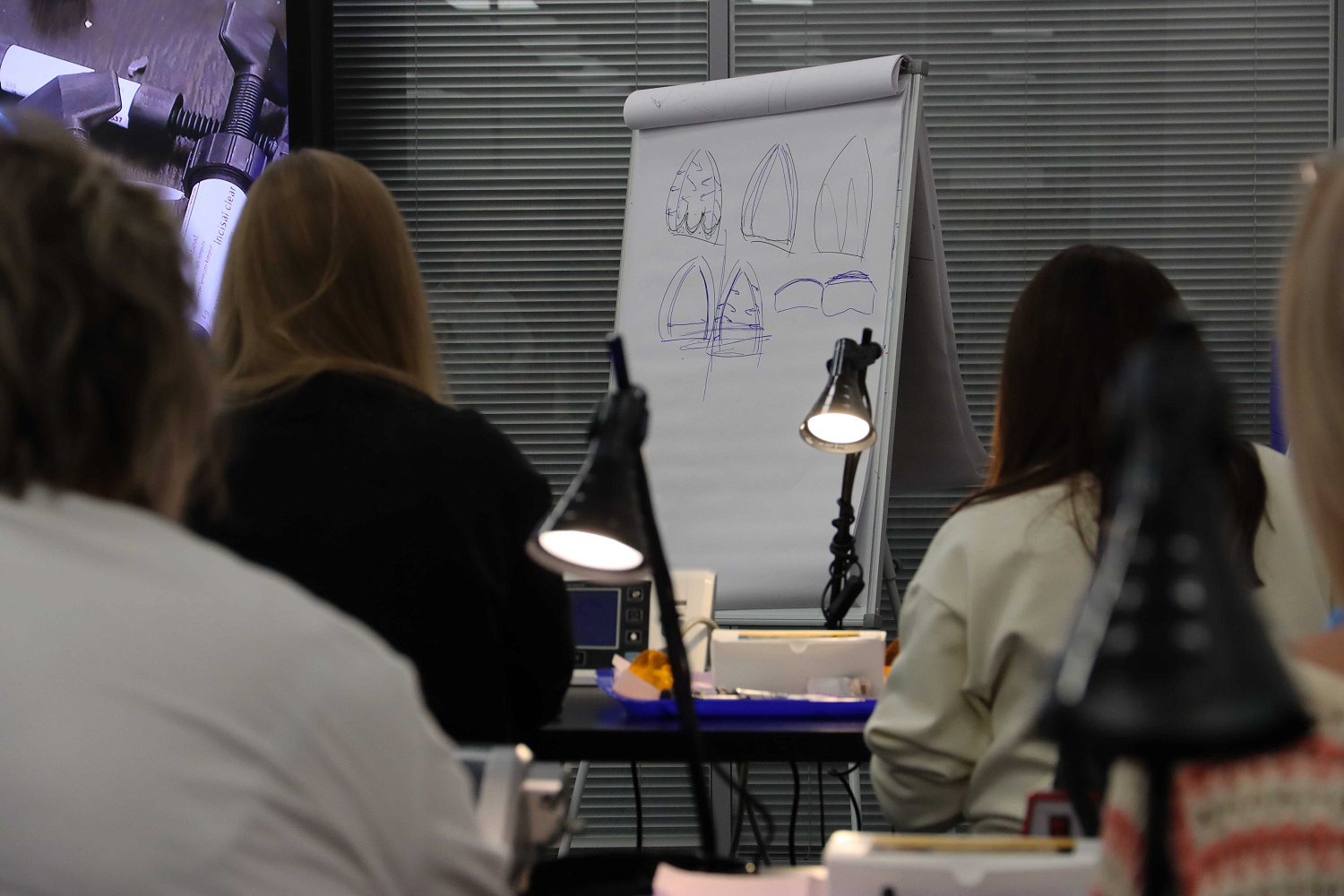 Прямые композитные виниры. Полный алгоритм и немного больше