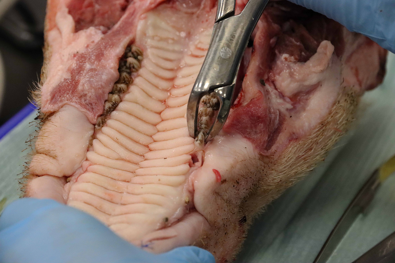 Атравматичное удаление зубов и методики наложения швов