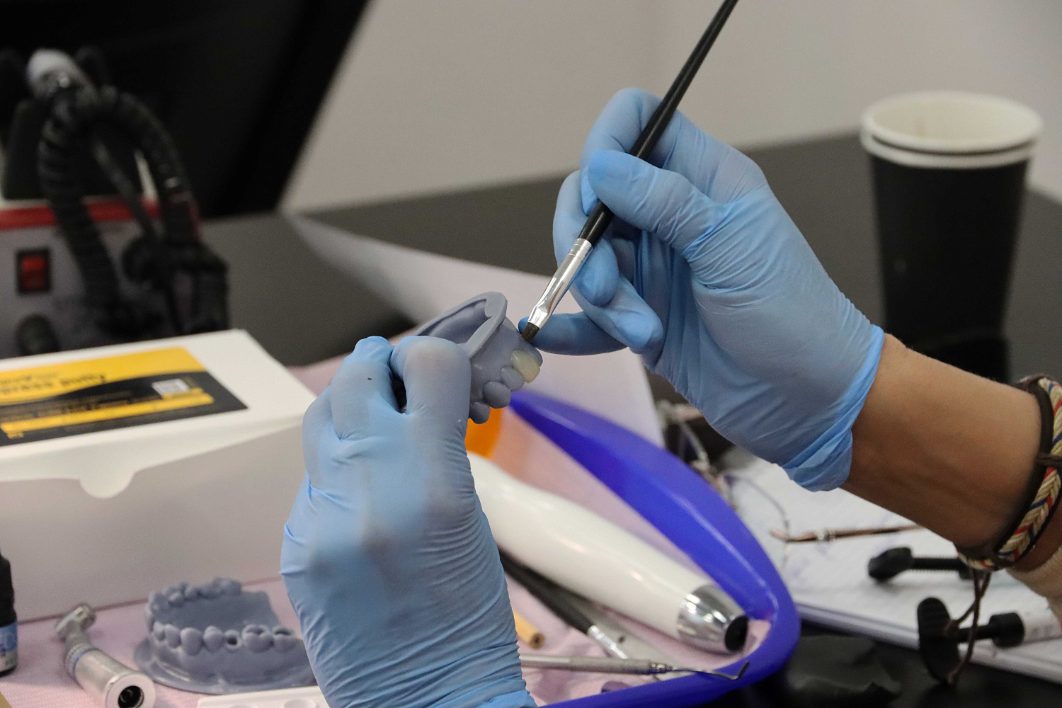 Прямые композитные виниры. Полный алгоритм и немного больше