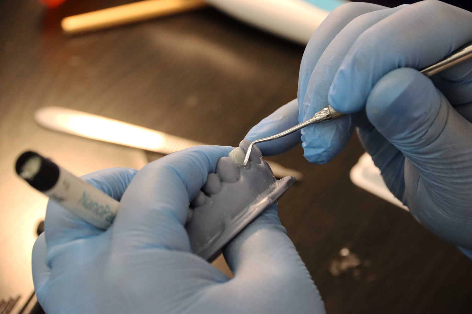 Прямые композитные виниры. Полный алгоритм и немного больше