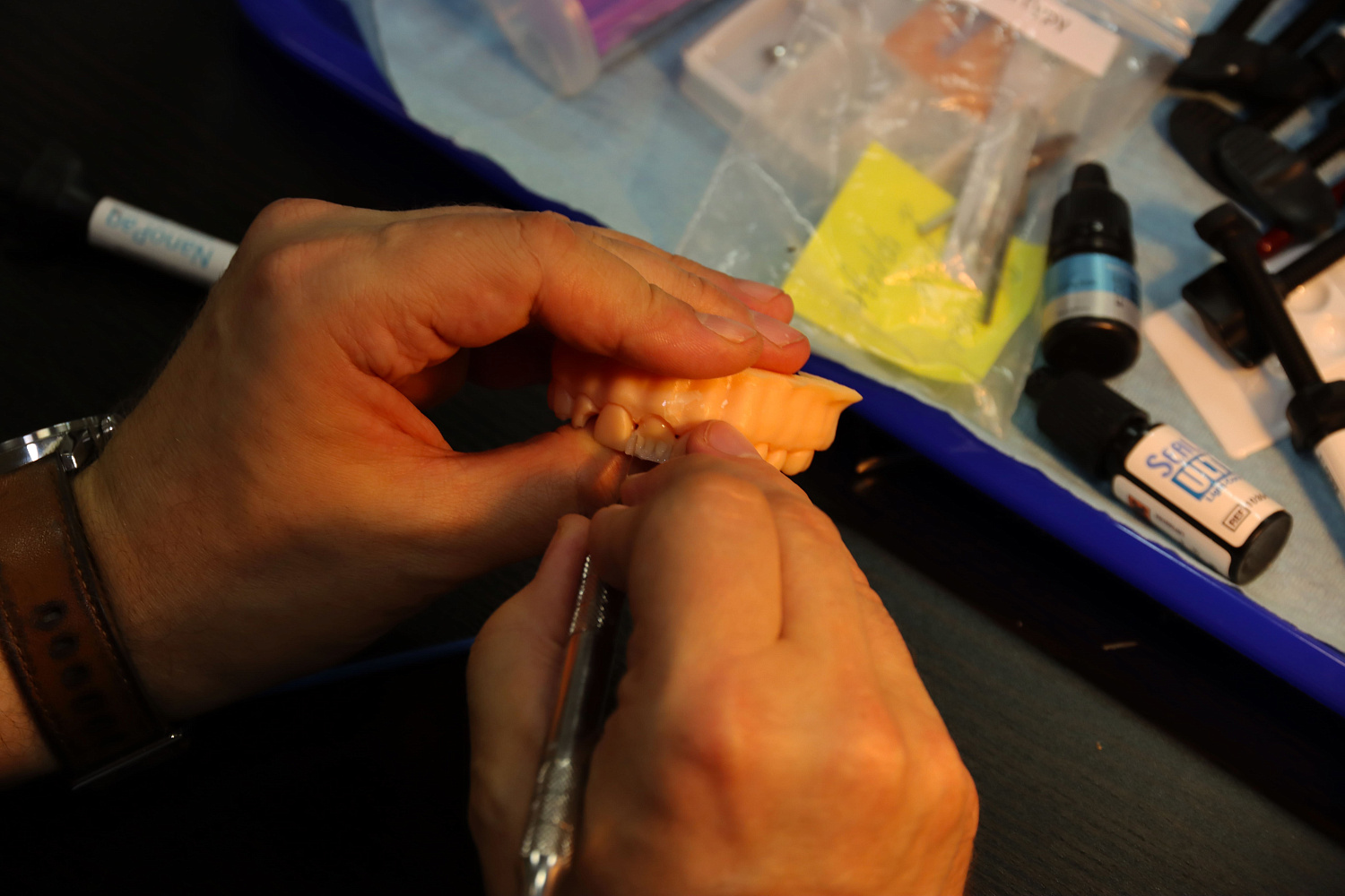 Прямые композитные виниры. Полный алгоритм и немного больше