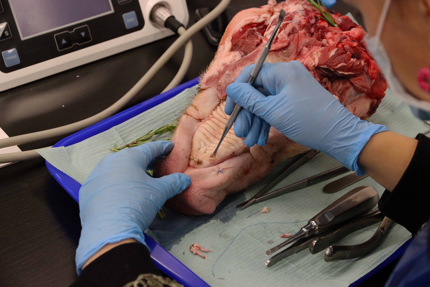 Атравматичное удаление зубов и методики наложения швов